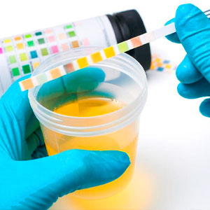 Taller de Análisis de Sangre y Orina