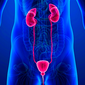 Taller de Emergencias Urológicas