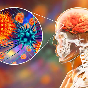 Taller de Meningitis