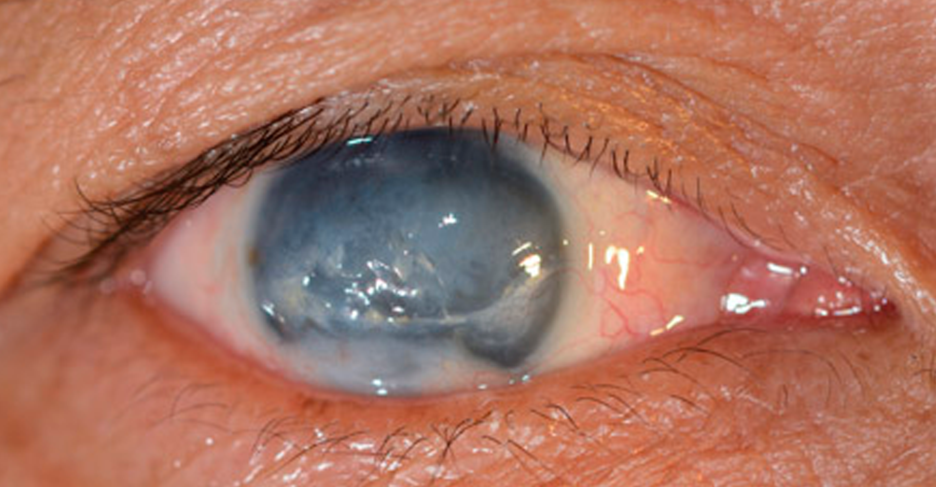 Taller de Institución Badra